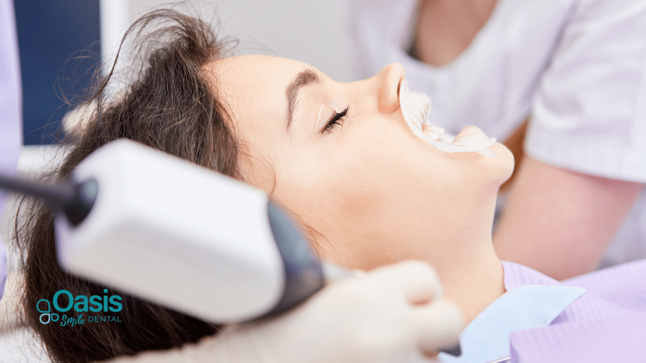 What Causes Tooth Discoloration Beyond Staining