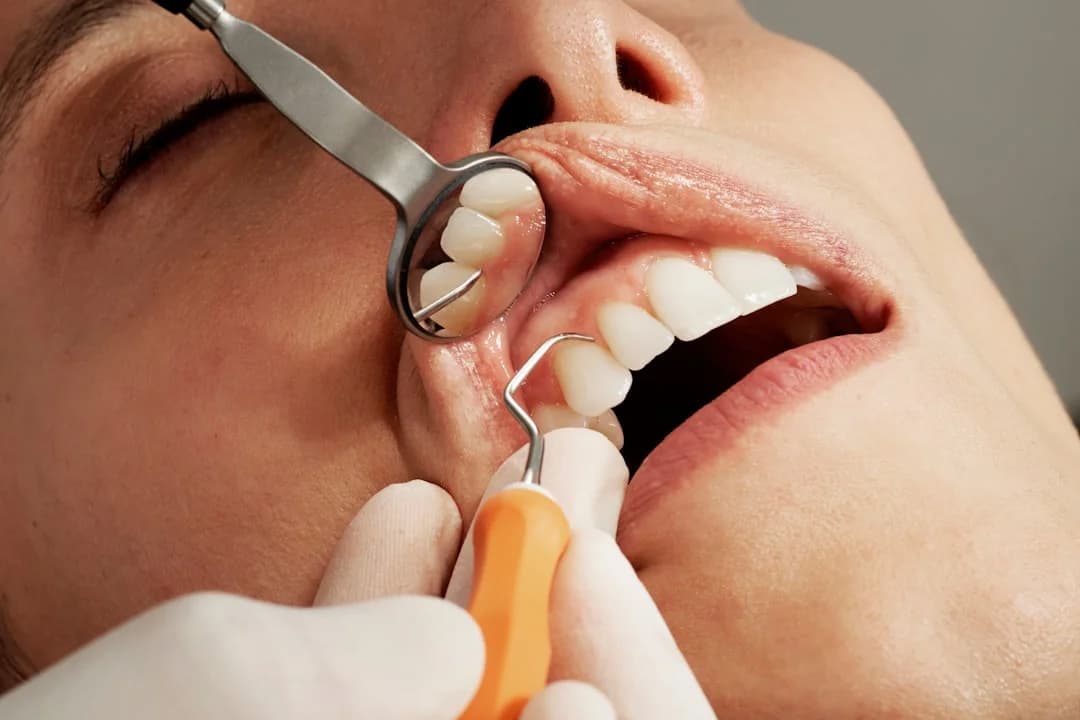 Composite Bonding Unveiled: Enhancing Aesthetics and Functionality in Calagary, AB