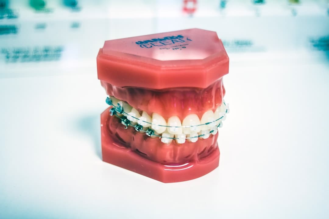 Photo Braces, Aligners